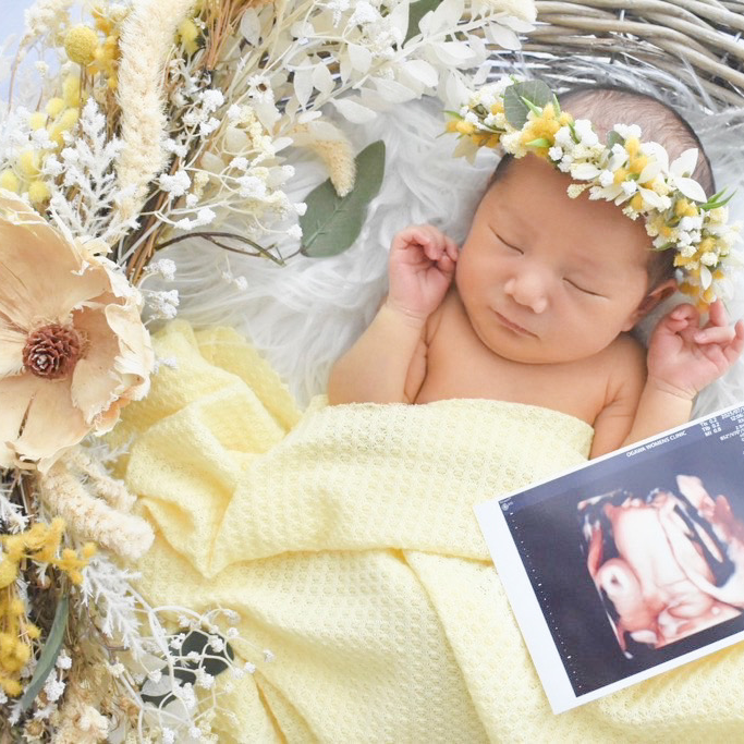 White yellow with Palm flowerスワッグリースセット